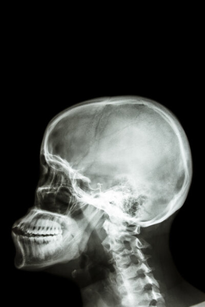human's skull and blank area at upper side for fill text