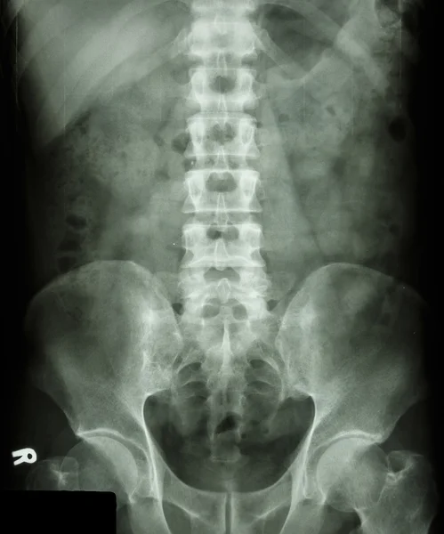 Нормальний задній хребет людини — стокове фото