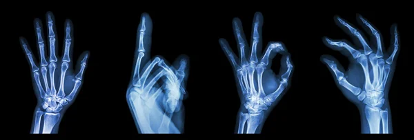 Collection X-ray symbol hands — Stock Photo, Image