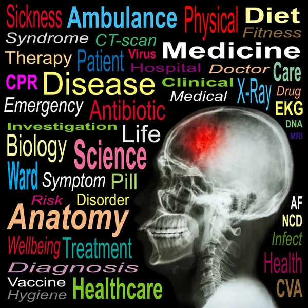 X 線頭骨および「一筆」と医療単語の雲 — ストック写真
