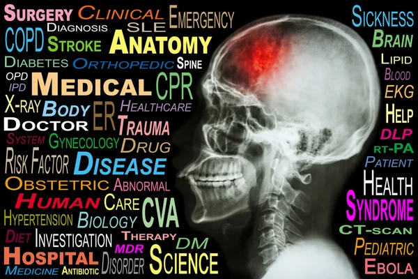 X-ray skull and "Stroke" and Medical word cloud — Stock Photo, Image