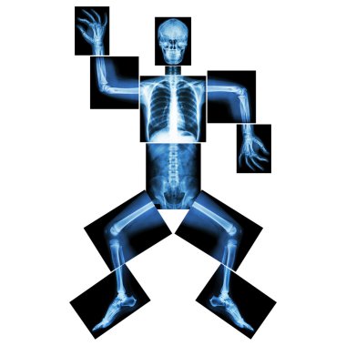 Aerobic Dance(human bone is dancing),(Whole body x-ray : head ,neck ,thorax ,shoulder ,arm ,elbow ,forearm ,hand ,finger ,joint ,thorax ,abdomen ,back,pelvis ,hip ,thigh ,leg ,knee ,foot ,heel ,ankle) clipart