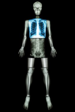 Akciğer sağlıklı (X-ray Tüm vücut : kafatası baş boyun omurga omuz göğüs toraks akciğer akciğer kalp kaburga dirsek önkol bilek el parmak arka karın pelvis kalça uyluk diz ayak bileği ayak topuk )