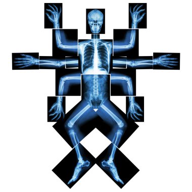 Canavar birçok kolu var. (X-ışını tüm vücut: baş boyun omuz kol ön kol dirsek bilek el basamak göğüs kaburga akciğer kalp omurga karın pelvik kalça uyluk bacak diz ayak bileği topuk ayak)