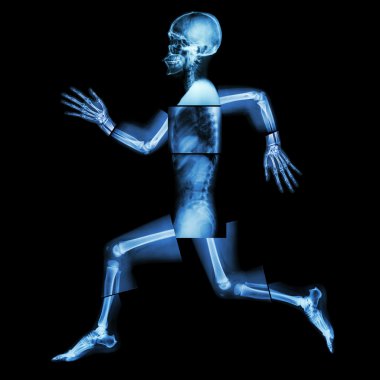 Aerobic Exercise (human bone is running) ,(Whole body x-ray : head ,neck ,shoulder ,shoulder ,arm ,elbow ,forearm ,hand ,finger ,joint ,thorax ,abdomen ,back,pelvis ,hip ,thigh ,leg ,knee ,foot ,heel) clipart