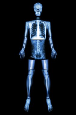 Anatomik Pozisyon. (X-Ray tüm vücut : baş ,boyun ,boyun ,göğüs , kalp , akciğer , kaburga , omuz , kürek kemiği , kol ,önkol , dirsek , bilek , el , basamak , karın , kalça , pelvik , bacak , uyluk , diz , ayak bileği , topuk , ayak )
