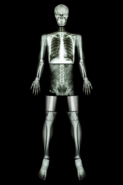 Anatomik Pozisyon. (X-Ray tüm vücut : baş ,boyun ,boyun ,göğüs , kalp , akciğer , kaburga , omuz , kürek kemiği , kol ,önkol , dirsek , bilek , el , basamak , karın , kalça , pelvik , bacak , uyluk , diz , ayak bileği , topuk , ayak )