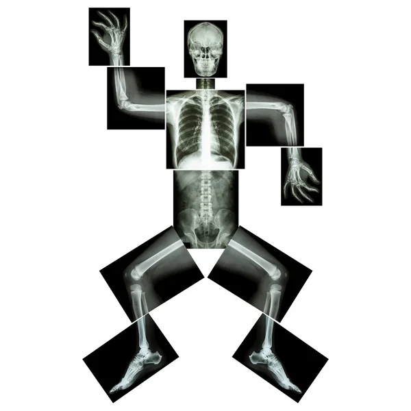 Danza aeróbica (hueso humano está bailando), (Radiografía de cuerpo entero: cabeza, cuello, tórax, hombro, brazo, codo, antebrazo, mano, dedo, articulación, tórax, abdomen, espalda, pelvis, cadera, muslo, pierna, rodilla, pie, talón, tobillo ) —  Fotos de Stock