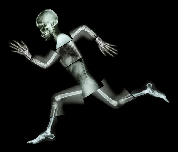 马拉松 (人骨运行)，(全身 x 射线: 头、 颈部、 肩、 臂、 肘、 前臂、 手、 手指、 联合、 胸部、 腹部、 背、 骨盆、 臀部、 大腿、 腿、 膝盖、 脚、 脚跟) — 图库照片