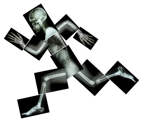 Marathon (human bone is running) ,(Whole body x-ray : head ,neck ,shoulder ,arm ,elbow ,forearm ,hand ,finger ,joint ,thorax ,abdomen ,back,pelvis ,hip ,thigh ,leg ,knee ,foot ,heel) — Stock Photo, Image