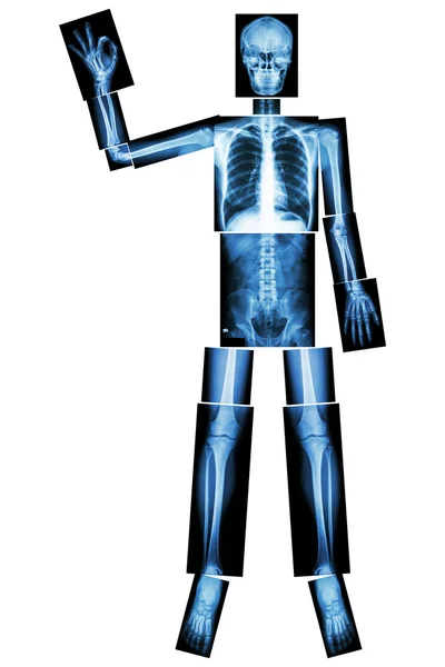 OK skeleton (Human bone raise the hand and OK sign) (Whole body : head neck spine shoulder arm elbow forearm wrist hand finger thorax heart lung back abdomen pelvis hip thigh leg knee foot ankle heel) — Stock Photo, Image