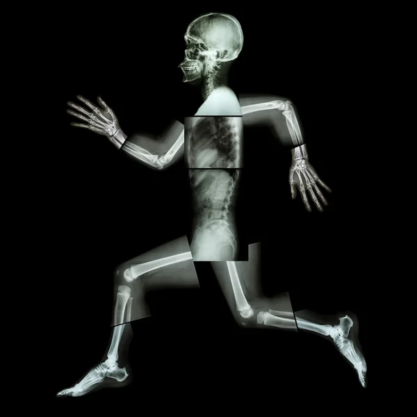 Aerobic (menschlicher Knochen läuft), (Ganzkörper-Röntgen: Kopf, Hals, Schulter, Schulter, Arm, Ellbogen, Unterarm, Hand, Finger, Gelenk, Brustkorb, Bauch, Rücken, Becken, Hüfte, Oberschenkel, Bein, Knie, Fuß, Ferse) — Stockfoto