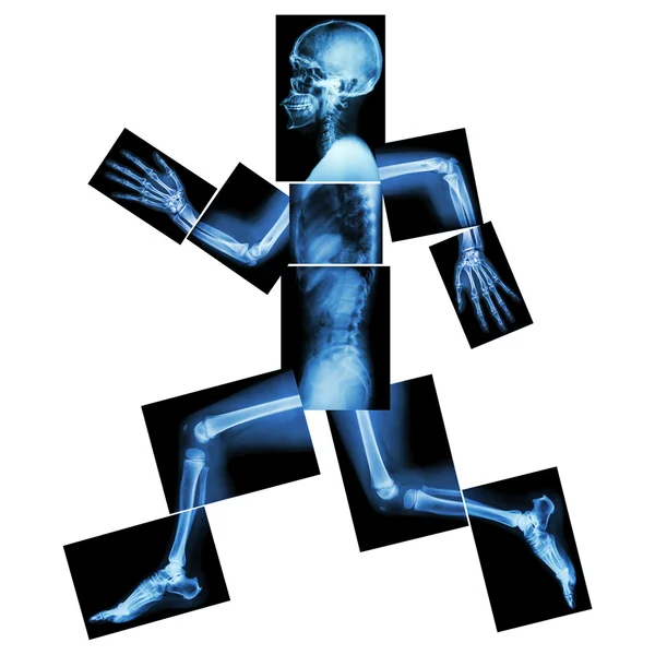 Aerobic Exercise (human bone is running) ,(Whole body x-ray : head ,neck ,shoulder ,shoulder ,arm ,elbow ,forearm ,hand ,finger ,joint ,thorax ,abdomen ,back,pelvis ,hip ,thigh ,leg ,knee ,foot ,heel) — Stock Photo, Image