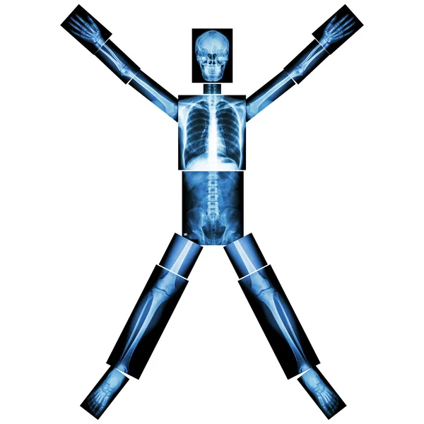 Людська кістка розтягує руку і ногу (ціле тіло: голова шия хребет спина живіт груди плечова рука лікоть передпліччя рука зап'ястя легень серце таз стегно стегно нога коліно ступня пальця п'ята  ) — стокове фото