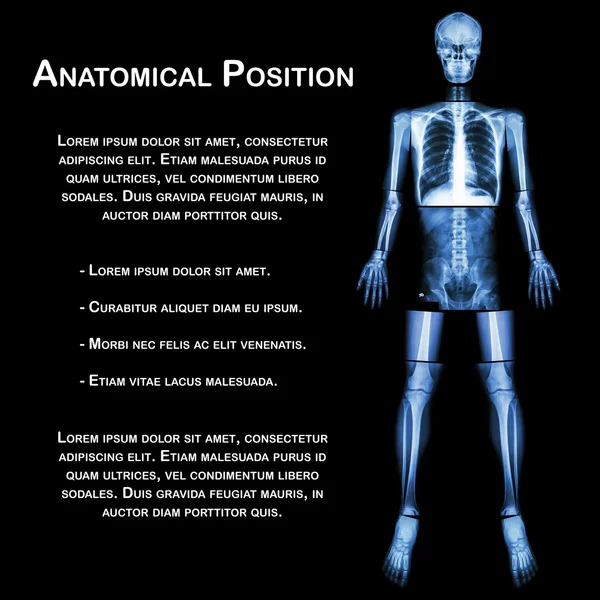 Posição Anatômica. (Raio-X corpo inteiro: cabeça, pescoço, tórax, coração, pulmão, costela, ombro, escápula, braço, antebraço, cotovelo, pulso, mão, dígito, abdômen, quadril, pélvico, perna, coxa, joelho, tornozelo, calcanhar, pé  ) — Fotografia de Stock