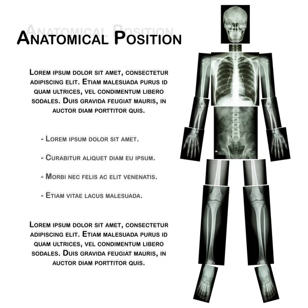 Posición anatómica. (Radiografía de cuerpo entero: cabeza, cuello, tórax, corazón, pulmón, costilla, hombro, escápula, brazo, antebrazo, codo, muñeca, mano, dígito, abdomen, cadera, pelvis, pierna, muslo, rodilla, tobillo, talón, pie  ) — Foto de Stock