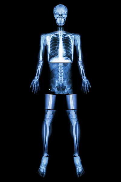 Anatomické postavení. (X-ray celé tělo: hlava, krk, hrudník, srdce, plíce, žebra, rameno, lopatka, paže, předloktí, loket, zápěstí, ruka, číslice, břicho, kyčel, pánevní, noha, stehna, kolena, kotník, pata, noha ) — Stock fotografie