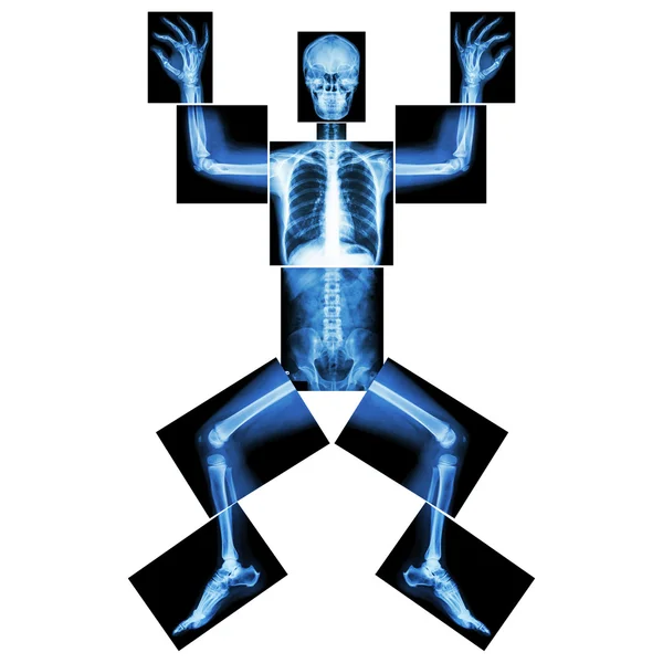 Jigsaw human x-ray ( whole body : head skull face neck spine shoulder arm elbow joint forearm wrist hand finger chest thorax heart lung rib abdomen back pelvis hip thigh knee leg ankle foot heel toe ) — Stock Photo, Image