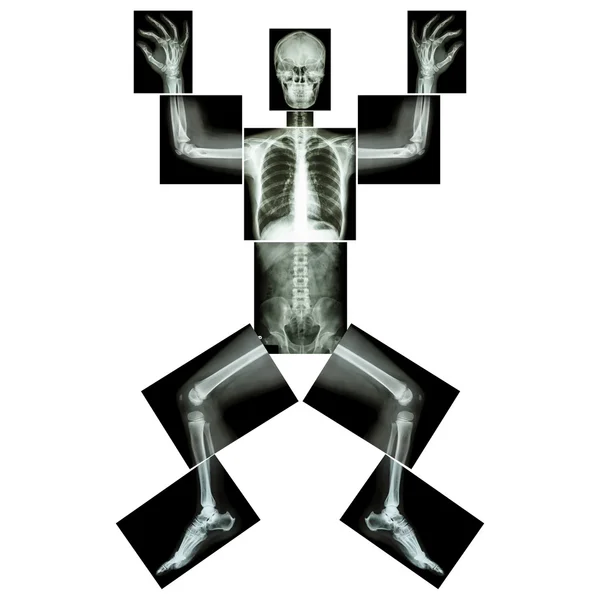 Skládačka lidský x-ray (celé tělo: hlava lebka tvář krk hřbet rameno paže ramenní kloub předloktí zápěstí ruka prst hrudník hrudník srdce plicní žebra břicho zadní pánev kyčelní stehno koleno nohy kotník noha zadní ) — Stock fotografie