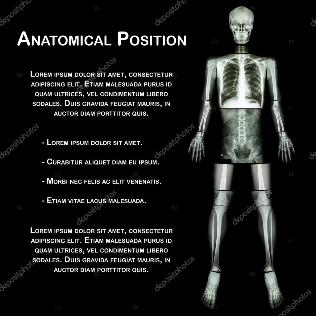 Anatomical Position. (Xray whole body head ,neck ,thorax ,heart