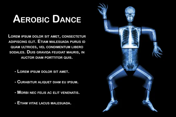 Aerobic tánc (emberi csont tánc), (egész test röntgen: fej, nyak, mellkas, váll, kar, könyök, alkar, kéz, ujj, közös, mellkas, has, hát, medence, csípő, comb, láb, térd, láb, sarok, boka) — Stock Fotó