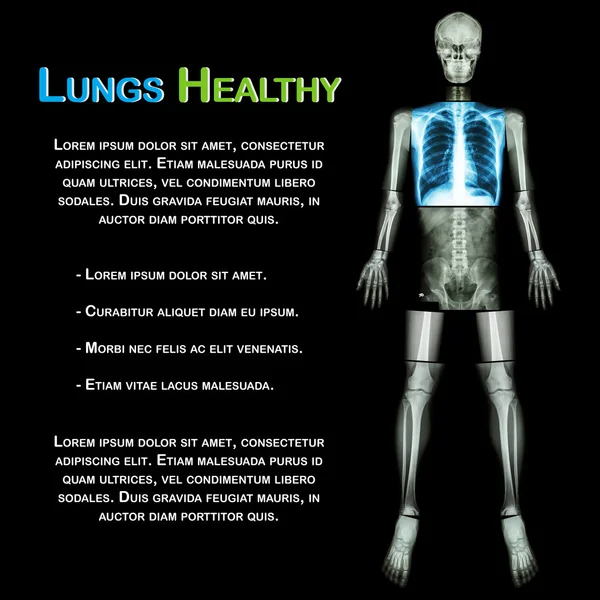 Pulmão saudável (Raio-X Corpo inteiro: cabeça do crânio pescoço coluna no ombro tórax pulmão coração pulmonar costela braço cotovelo antebraço pulso mão dedo de volta abdômen pélvis quadril coxa joelho perna tornozelo pé calcanhar  ) — Fotografia de Stock