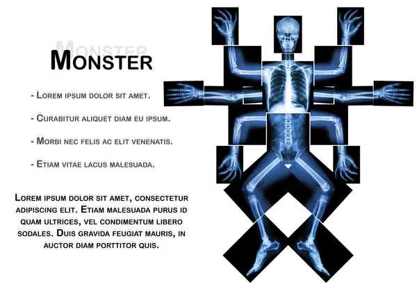 Monster have many arm. (X-ray whole body : head neck shoulder arm forearm elbow wrist hand digit thorax rib lung heart spine abdomen pelvic hip thigh leg knee ankle heel foot) — Stock Photo, Image