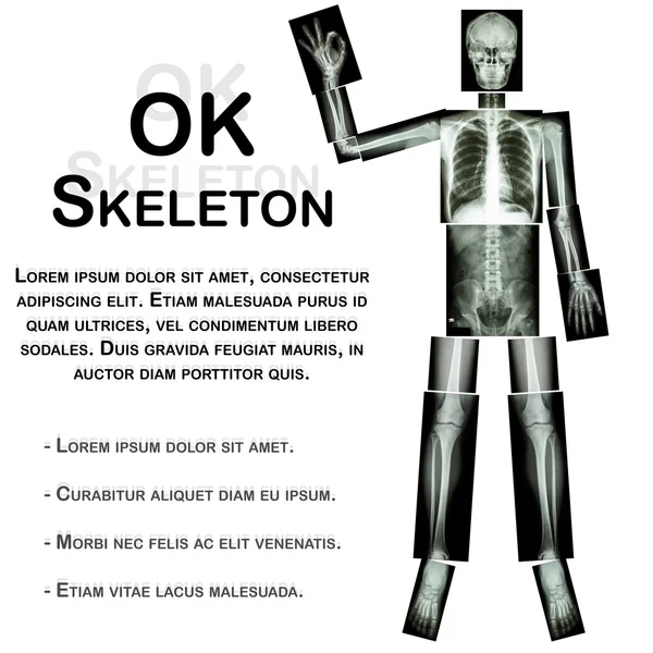 OK esqueleto (osso humano levantar a mão e OK sinal) (Corpo inteiro: cabeça pescoço espinha ombro braço cotovelo antebraço pulso mão dedo tórax coração pulmão volta abdômen pélvis quadril coxa perna joelho pé tornozelo calcanhar ) — Fotografia de Stock