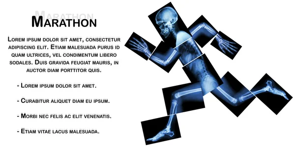 Marathon (l'os humain court), (Radiographie du corps entier : tête, cou, épaule, bras, coude, avant-bras, main, doigt, articulation, thorax, abdomen, dos, bassin, hanche, cuisse, jambe, genou, pied, talon ) — Photo