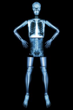 İnsan kemik standı ve akimbo (X-Ray tüm vücut : baş kafatası boyun omurga omuz kol dirsek önkol bilek el parmağı göğüs toraks kalp akciğer karın geri vertebra pelvis kalça uyluk diz ayak bileği ayak )