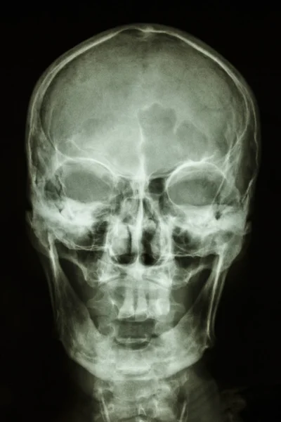 Обычный человеческий череп — стоковое фото