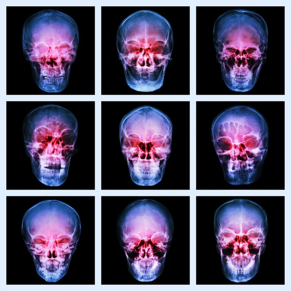 Collection of asian's skull — Stock Photo, Image