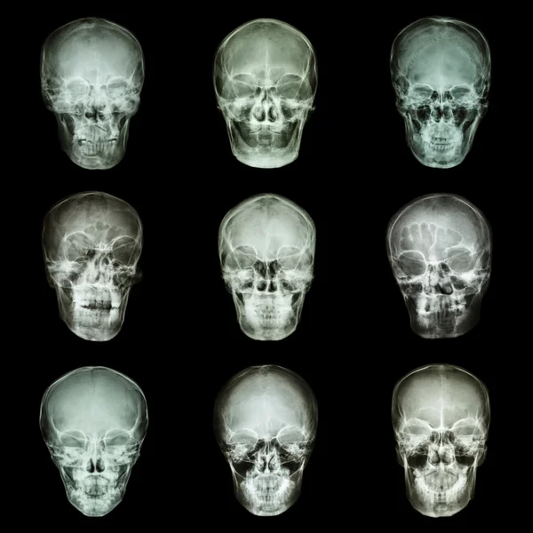 Collection of asian's skull — Stock Photo, Image
