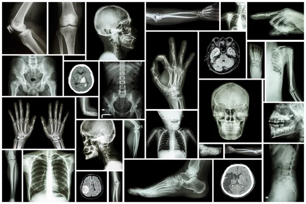 Sammlung Röntgen mehrerer Teile des Menschen — Stockfoto