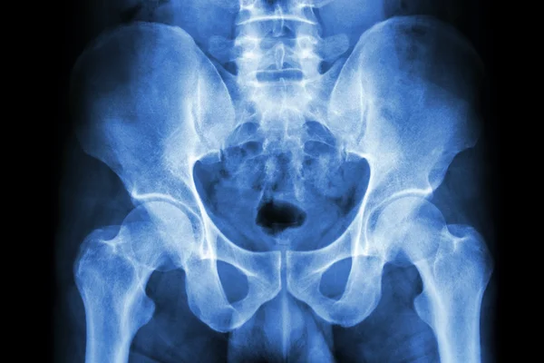 Pelvis humana y articulaciones de cadera — Foto de Stock