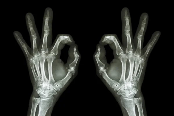 X 射线双手捧出 Ok 的手势 — 图库照片