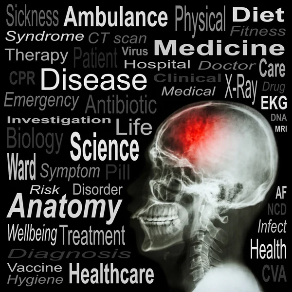 Cráneo de rayos X y texto médico —  Fotos de Stock