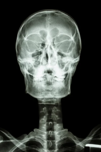 Normala mänskliga kraniet och halskotpelaren — Stockfoto