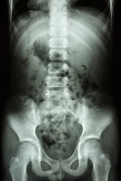 Coluna, abdómen, pélvis, anca da criança — Fotografia de Stock