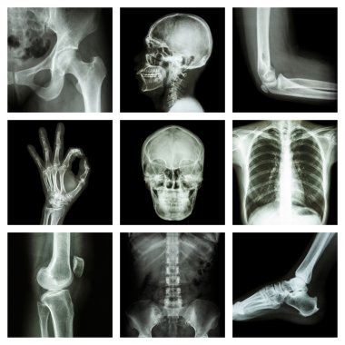 Koleksiyon X-ray insan parçası