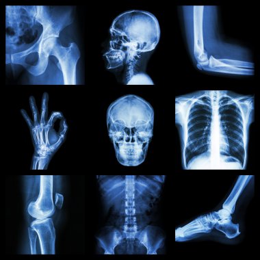 Collection X-ray part of human clipart