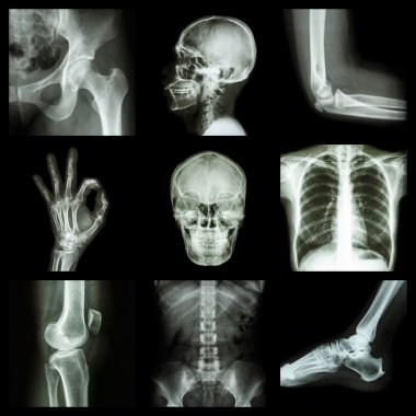Koleksiyon X-ray insan parçası