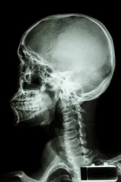 Cranio umano e colonna vertebrale cervicale — Foto Stock