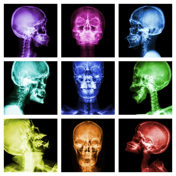 Collection of asian skull — Stock Photo, Image