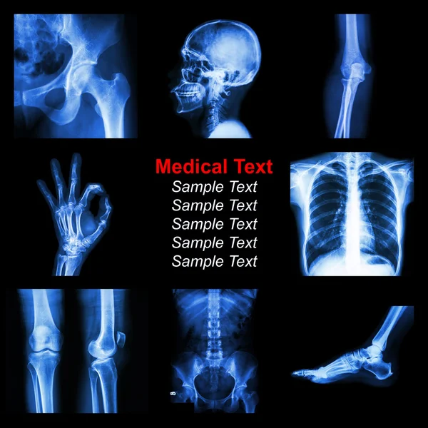 Colección de parte de rayos X de humanos — Foto de Stock