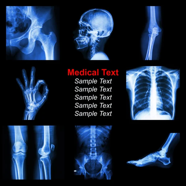 Kolekcja RTG części człowieka — Zdjęcie stockowe