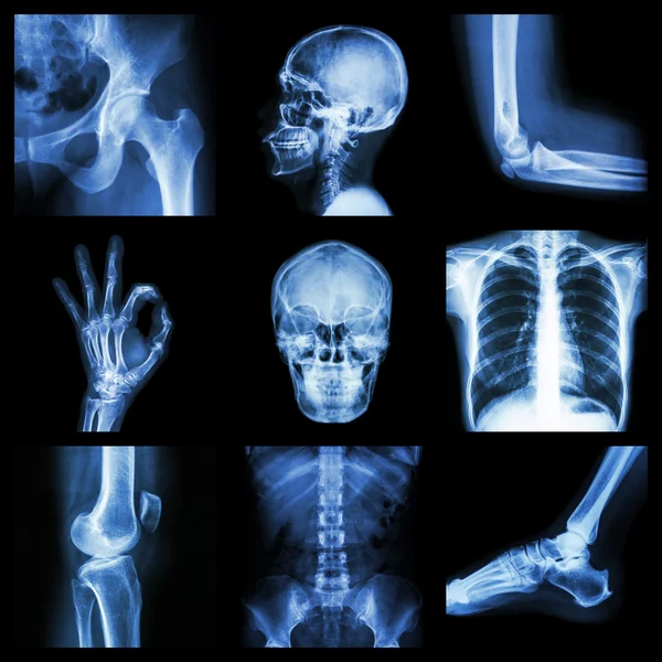 Colección de rayos X parte de humano —  Fotos de Stock