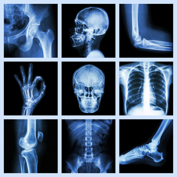 Рентгеновская часть человека

