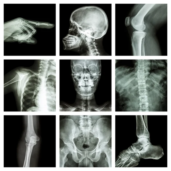 Coleção de raios-X parte do ser humano (Versão 2 ) — Fotografia de Stock