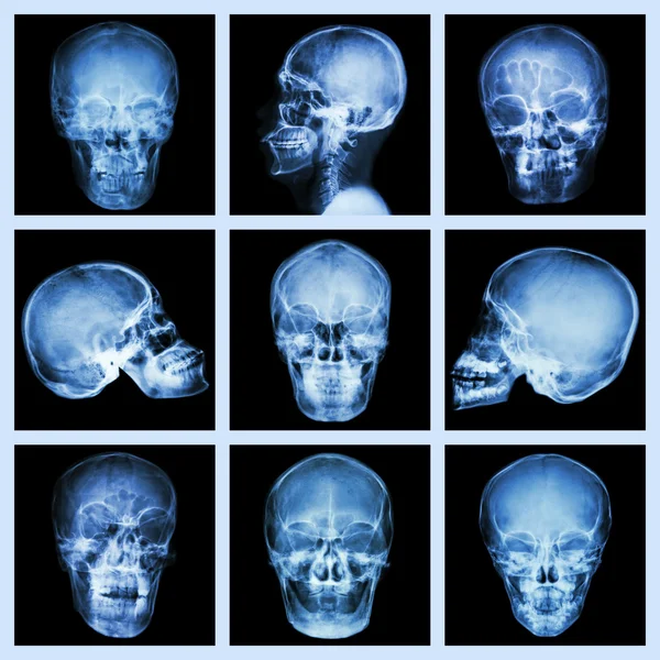 Colección de cráneo asiático — Foto de Stock